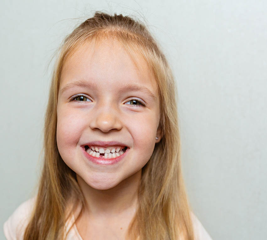 Child with Crooked teeth